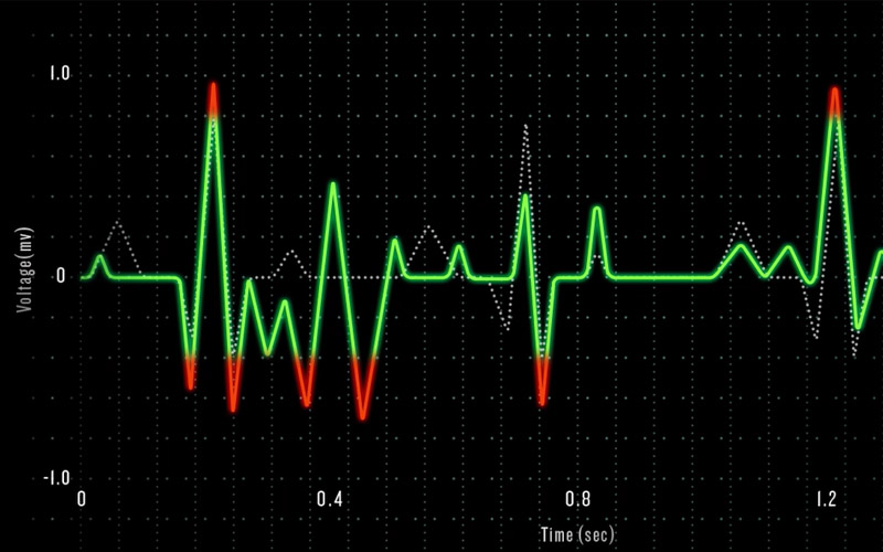 Tính năng theo dõi nhịp tim ở cổ tay Garmin Elevate là gì? > Loại bỏ nhiễu động